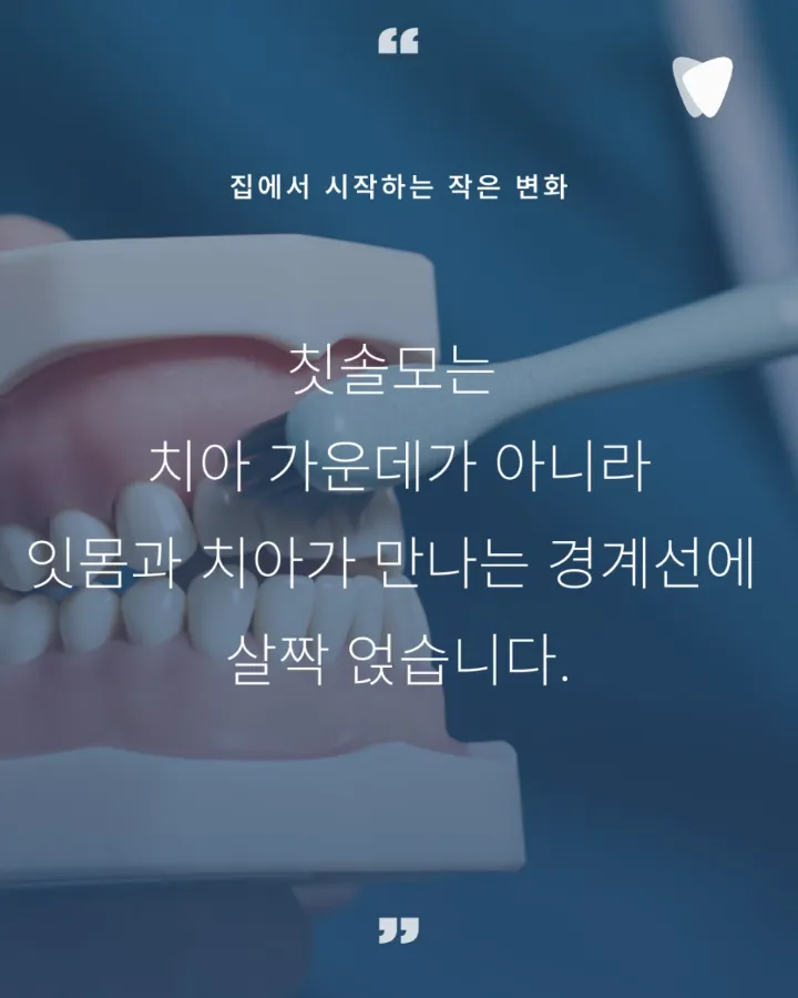 이미지 카드 · 잇몸병은 왜 재발할까? 치료보다 중요한 것, 잇몸을 오래 쓰는 설계