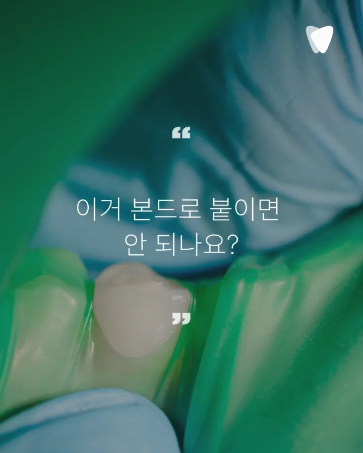 이미지 카드 · 치아가 깨졌을 때 바로 치료하지 않는 이유 — 균열 판단의 기준