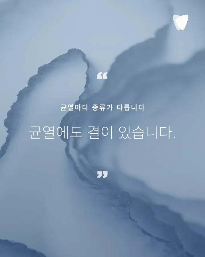 이미지 카드 · 치아가 깨졌을 때 바로 치료하지 않는 이유 — 균열 판단의 기준
