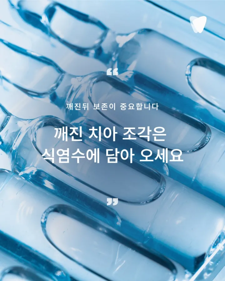 이미지 카드 · 치아가 깨졌을 때 바로 치료하지 않는 이유 — 균열 판단의 기준