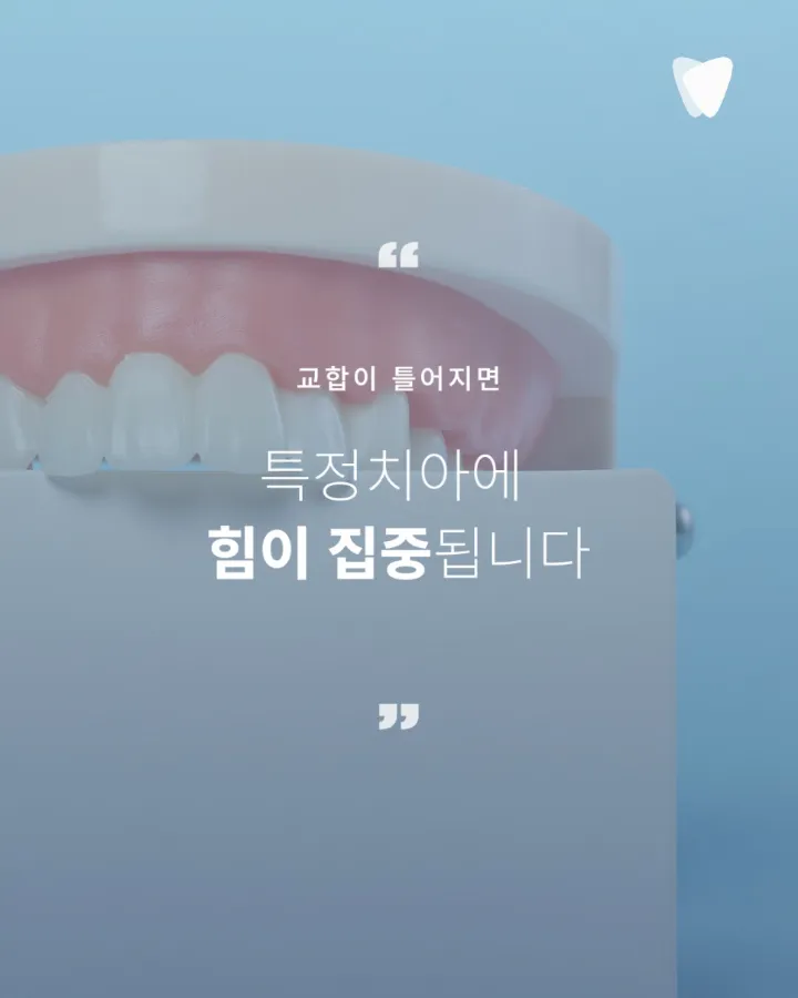 이미지 카드 · 늦은 시작이 아닙니다 — 치아 교정은 지금 이 치아를 20년 더 쓰기 위한 선택