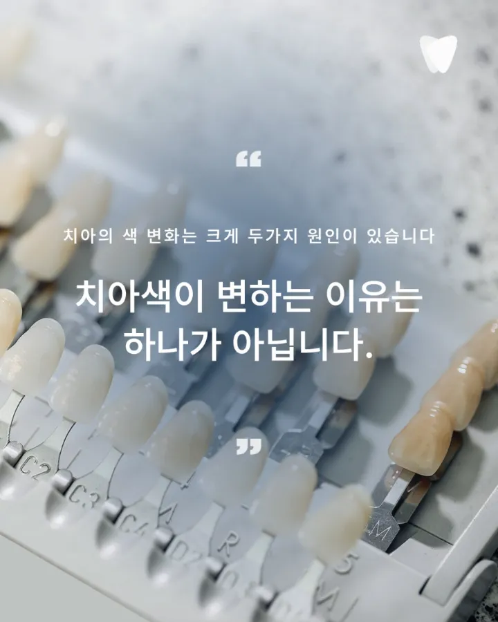 이미지 카드 · 치아가 조용히 말을 거는 방식 — 색이 바뀐다는 것의 의미