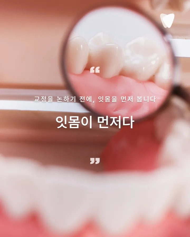 이미지 카드 · 30년을 참아온 미소, 1년 만에 회복하기