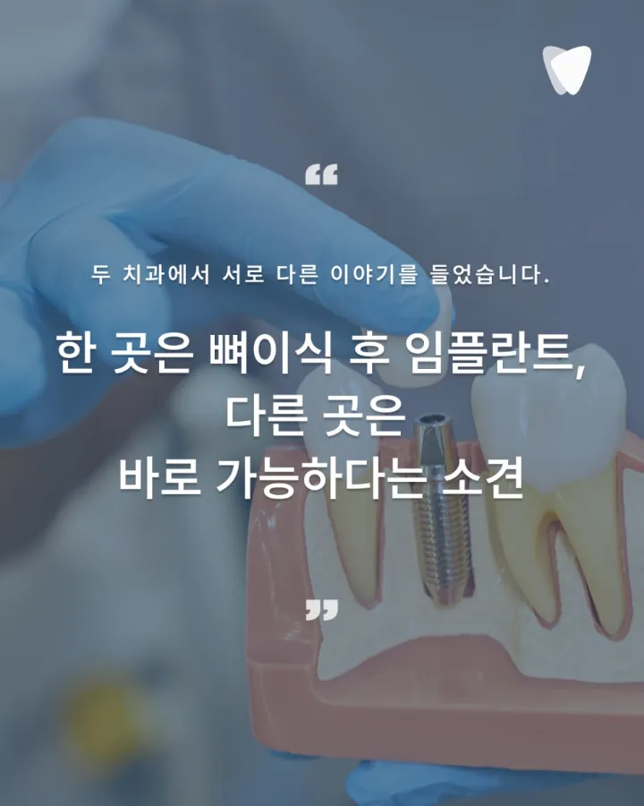 이미지 카드 · 임플란트 전 뼈가 부족하다는 진단, 정말 뼈이식이 꼭 필요할까?