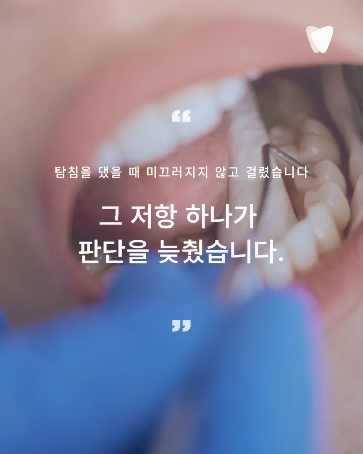 이미지 카드 · 초기 충치 레진 치료, 깎지 않고 지켜볼 수 있는 기준은 무엇인가