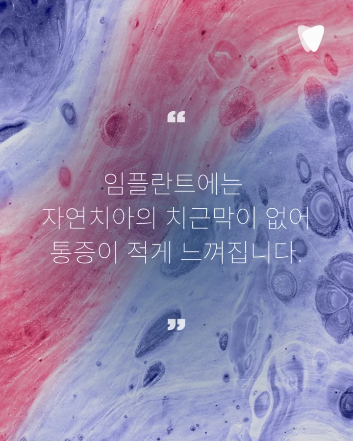 이미지 카드 · 임플란트 후 관리, 자연치아와 무엇이 다른가요 — 통증 없어도 확인해야 하는 이유