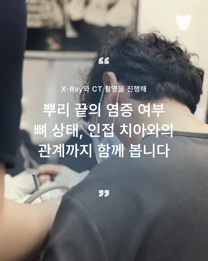 이미지 카드 · 신경치료 꼭 해야 하나요? 치아를 살리는 기준