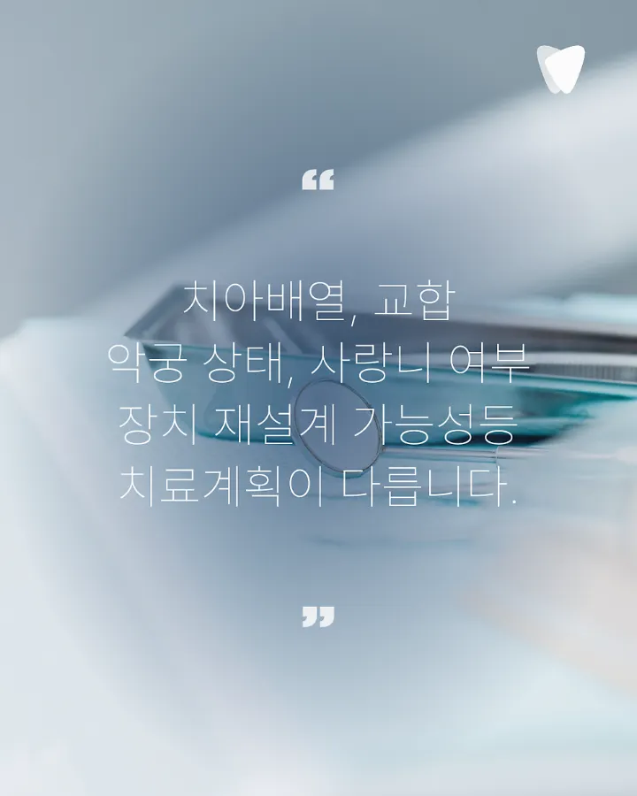 이미지 카드 · 운정 투명교정 비용 궁금하신가요? 가격보다 먼저 보셔야 할 것들