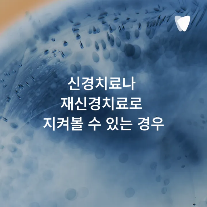 이미지 카드 · 운정 치아 뿌리 염증, 무조건 발치해야 할까요?