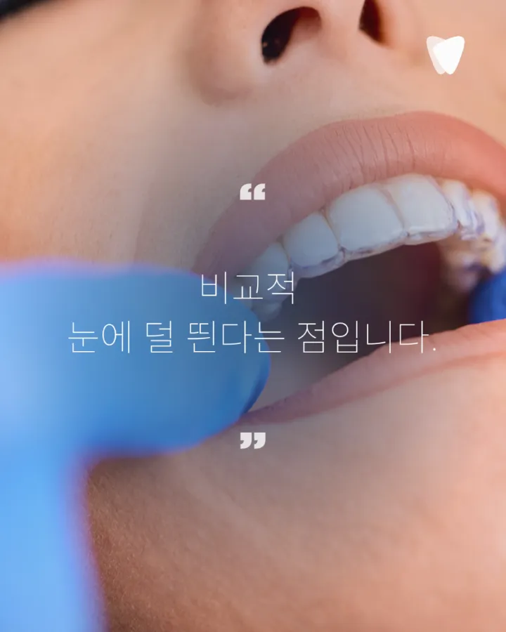 이미지 카드 · 운정 투명교정, 티 덜 나는 교정을 찾는 분께