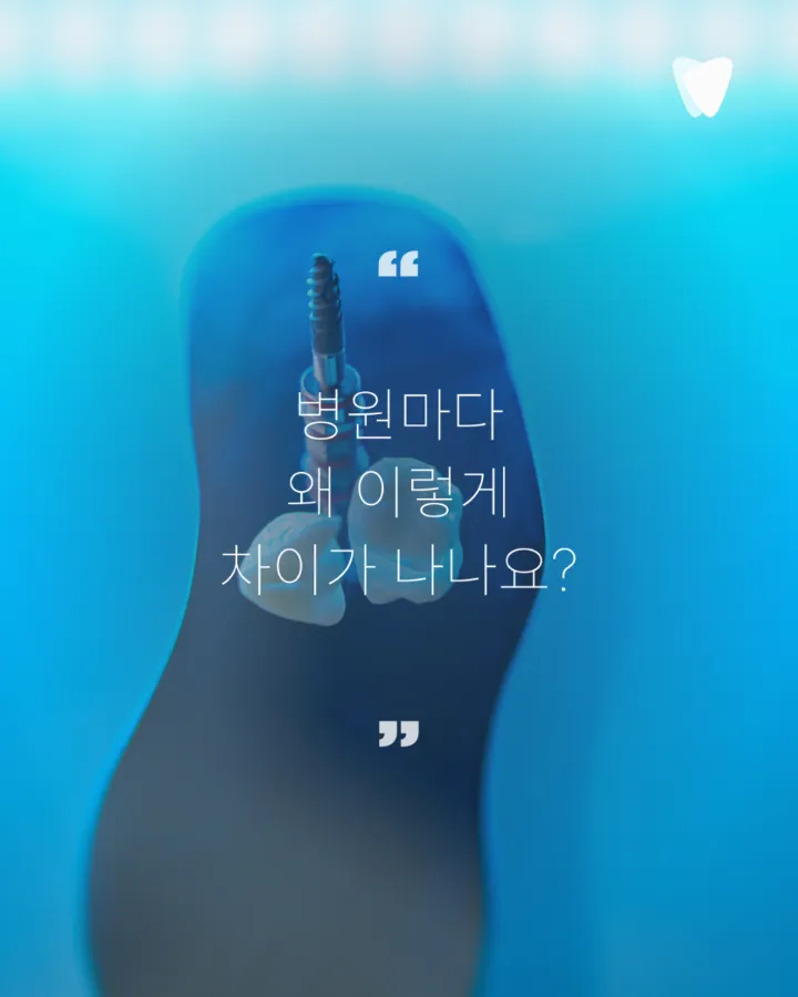 이미지 카드 · 운정 임플란트 비용, 숫자보다 먼저 확인해야 할 것