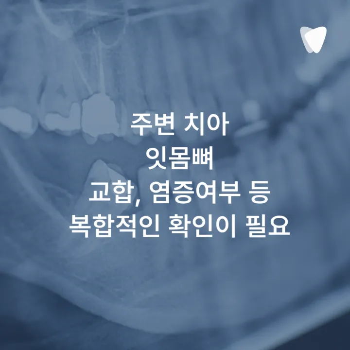 이미지 카드 · 운정 임플란트 비용, 숫자보다 먼저 확인해야 할 것