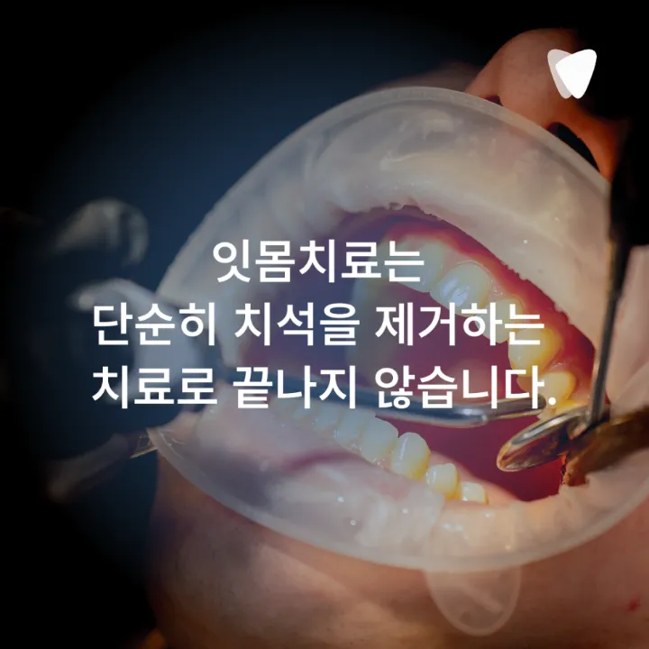 이미지 카드 · 당뇨가 있으면 잇몸치료 전 혈당을 왜 확인할까요?