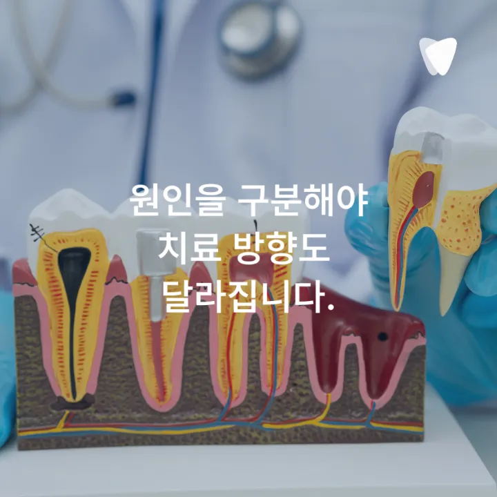 이미지 카드 · 운정 임플란트, 발치 전 꼭 확인할 기준