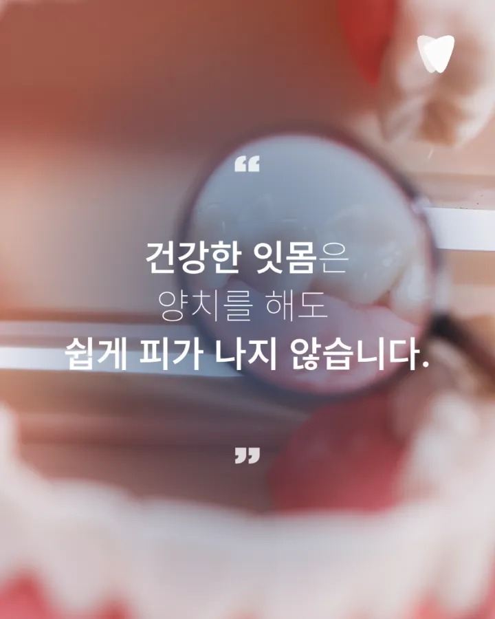 이미지 카드 · 양치할 때 잇몸에서 피가 나는 이유와 확인할 점