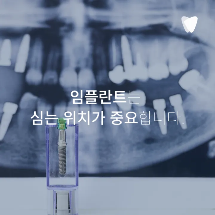 이미지 카드 · 파주 임플란트 치과, 재료와 관리 기준을 봐야 하는 이유