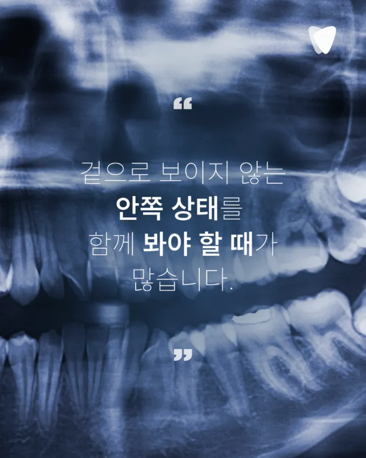 이미지 카드 · 치과 CT 꼭 찍어야 하나요? 사진·엑스레이를 찍는 이유