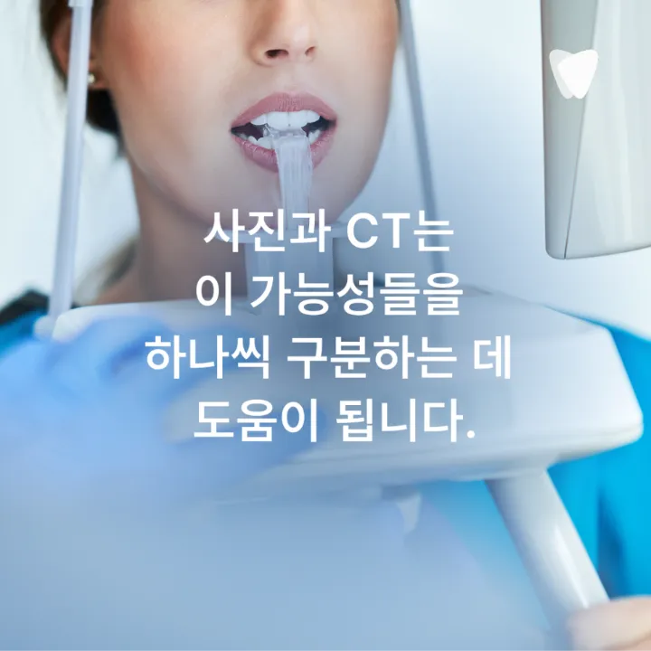 이미지 카드 · 치과 CT 꼭 찍어야 하나요? 사진·엑스레이를 찍는 이유