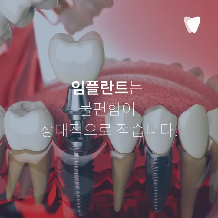 이미지 카드 · 임플란트·틀니·브릿지, 부모님께 맞는 선택 기준