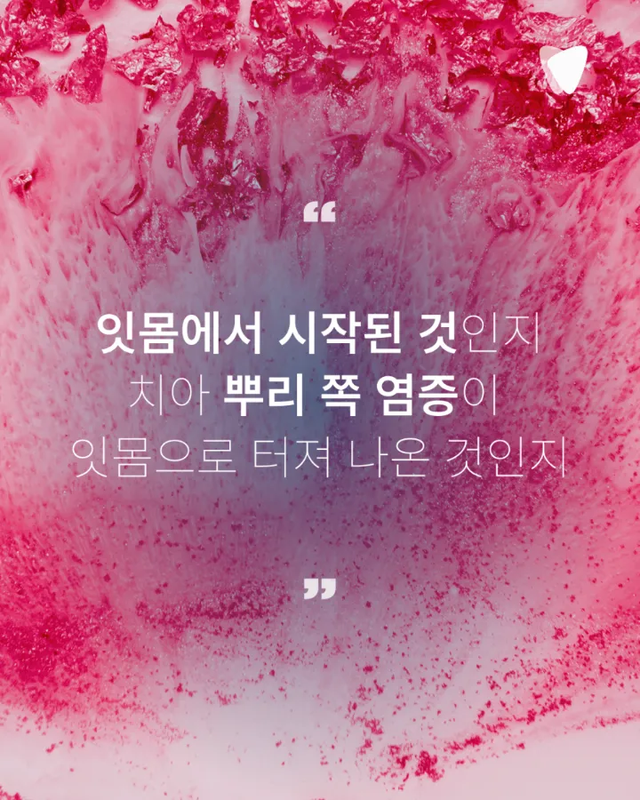 이미지 카드 · 잇몸이 붓고 고름이 날 때 먼저 의심할 수 있는 문제
