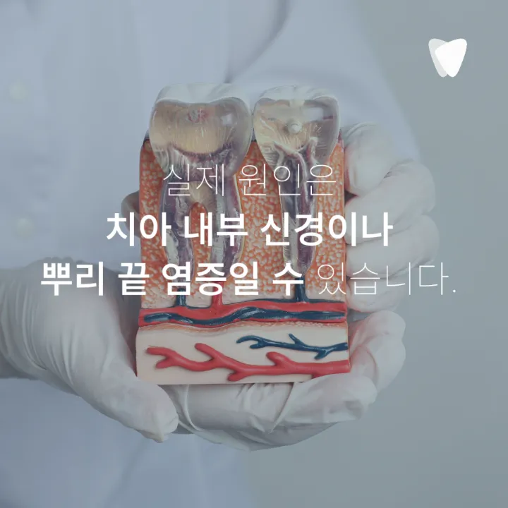 이미지 카드 · 잇몸이 붓고 고름이 날 때 먼저 의심할 수 있는 문제