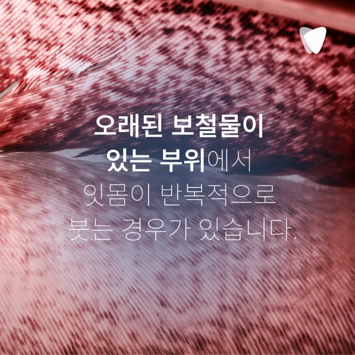 이미지 카드 · 잇몸이 붓고 고름이 날 때 먼저 의심할 수 있는 문제