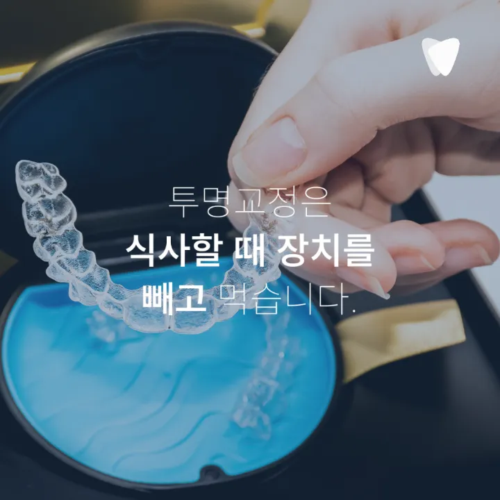 이미지 카드 · 투명교정 장점, 브라켓보다 편한 부분은 무엇일까요?