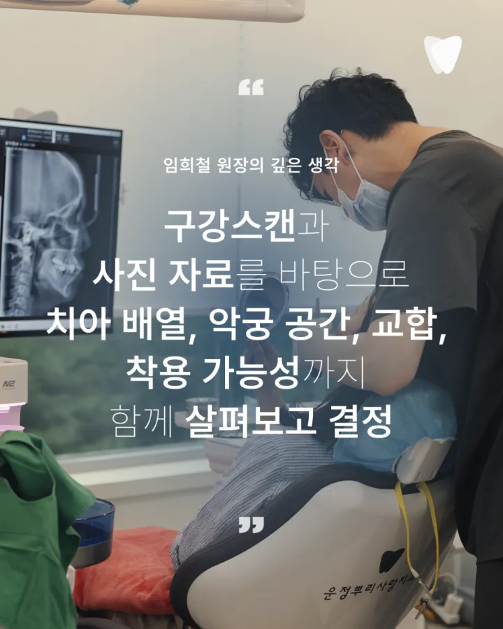 이미지 카드 · 투명교정 장점, 브라켓보다 편한 부분은 무엇일까요?