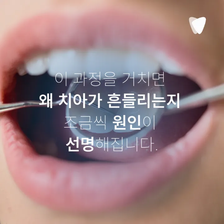 이미지 카드 · 치아가 흔들리는 느낌이 들 때 잇몸부터 봐야 하는 이유