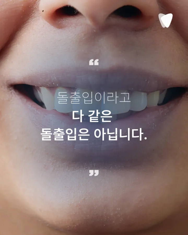 이미지 카드 · 돌출입 때문에 투명교정을 알아보고 계신가요?