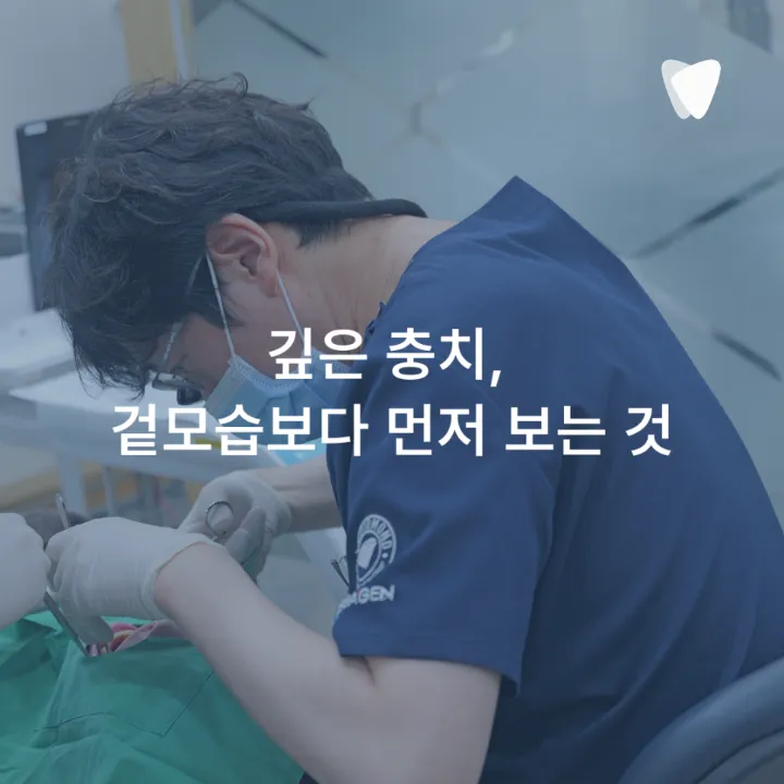 이미지 카드 · 충치가 깊어도 치아를 살릴 수 있는 경우