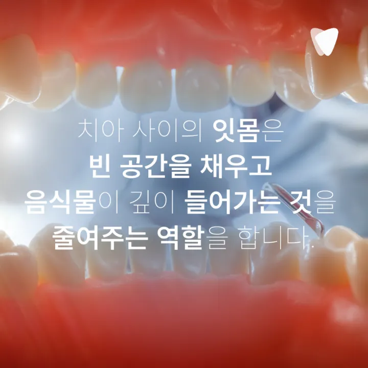 이미지 카드 · 치아가 길어 보이고 시리다면? 잇몸이 내려앉을 때 생기는 5가지 변화