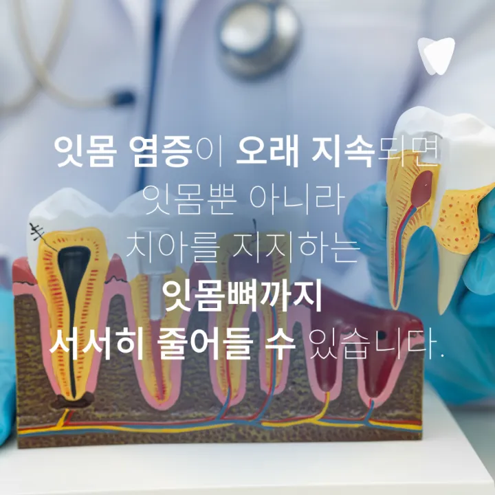 이미지 카드 · 치아가 길어 보이고 시리다면? 잇몸이 내려앉을 때 생기는 5가지 변화