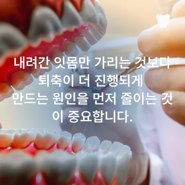 이미지 카드 · 치아가 길어 보이고 시리다면? 잇몸이 내려앉을 때 생기는 5가지 변화