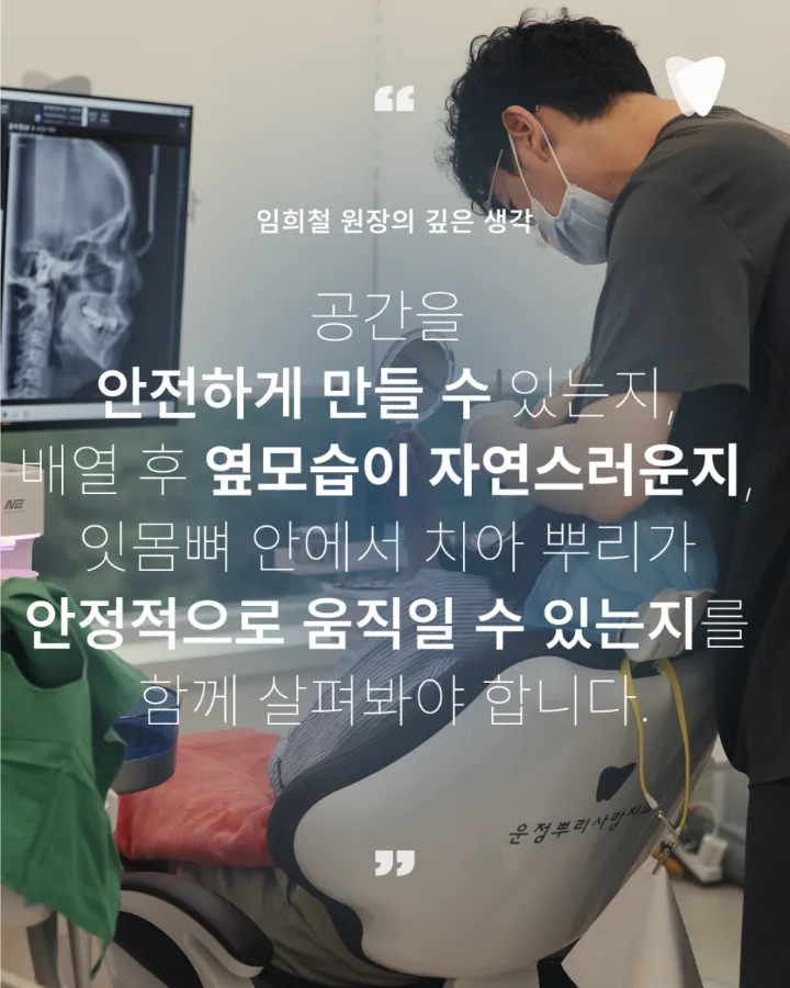 이미지 카드 · 운정 덧니 투명교정, 발치 없이 가능할까요?