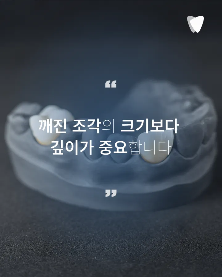 이미지 카드 · 치아가 깨졌을 때 당일 치과에 가야 할까요? 바로 확인할 6가지