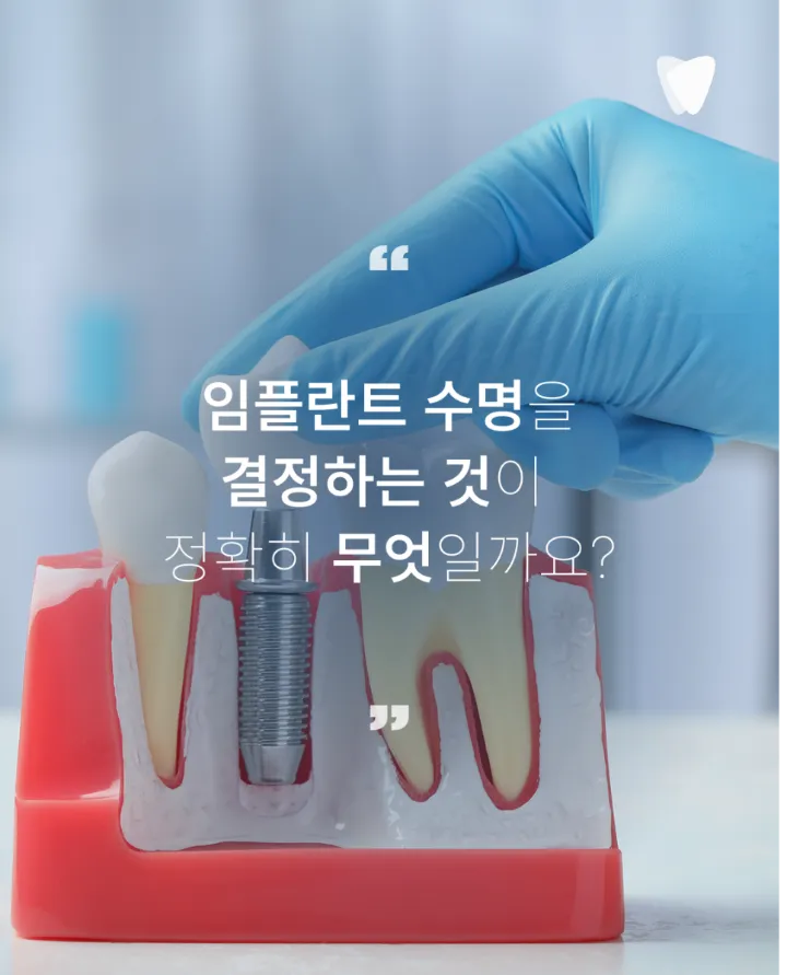 이미지 카드 · 운정 임플란트 수명, 오래 쓰려면 무엇이 중요할까요