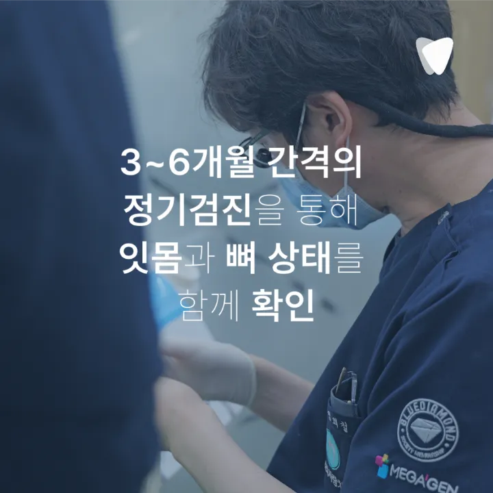 이미지 카드 · 운정 임플란트 수명, 오래 쓰려면 무엇이 중요할까요