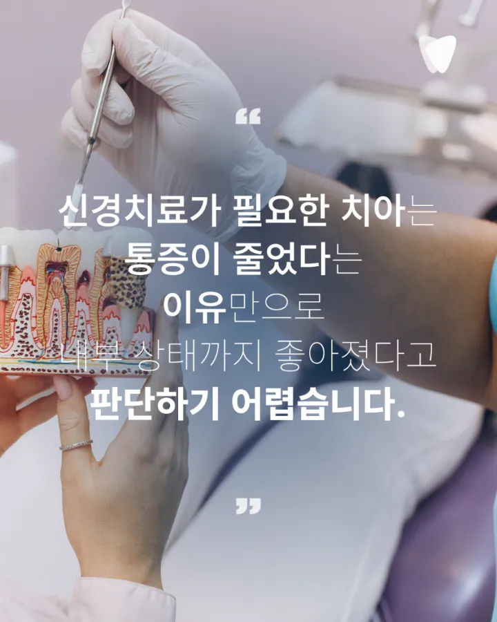 이미지 카드 · 신경치료 미루면 어떻게 될까요? 통증 없어도 치료 범위가 커지는 이유