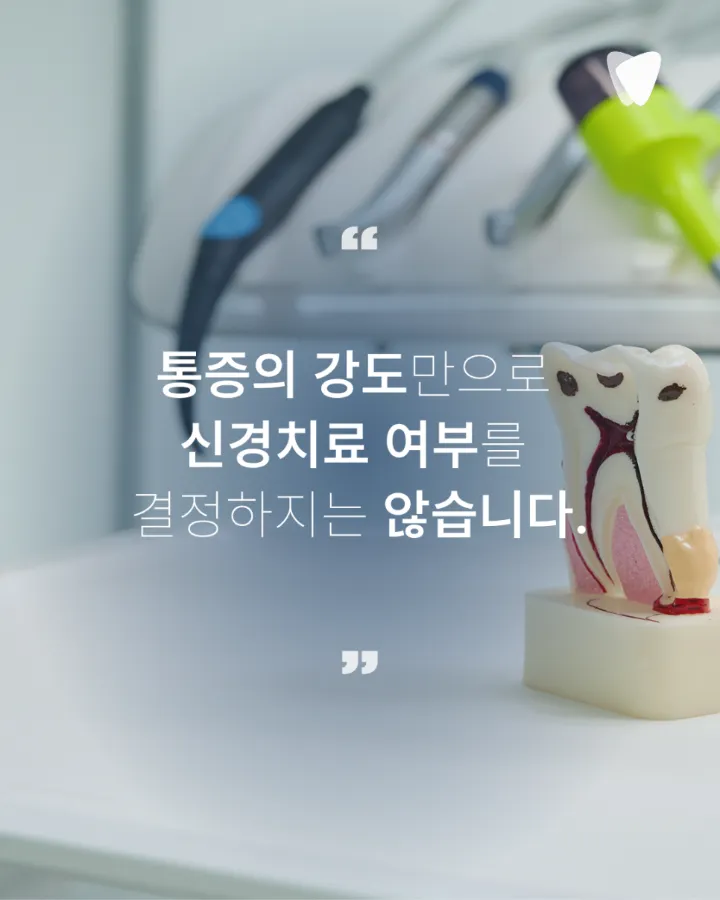 이미지 카드 · 신경치료 미루면 어떻게 될까요? 통증 없어도 치료 범위가 커지는 이유