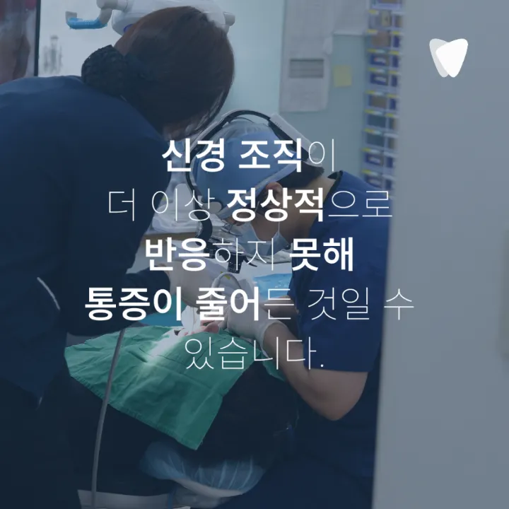 이미지 카드 · 신경치료 미루면 어떻게 될까요? 통증 없어도 치료 범위가 커지는 이유