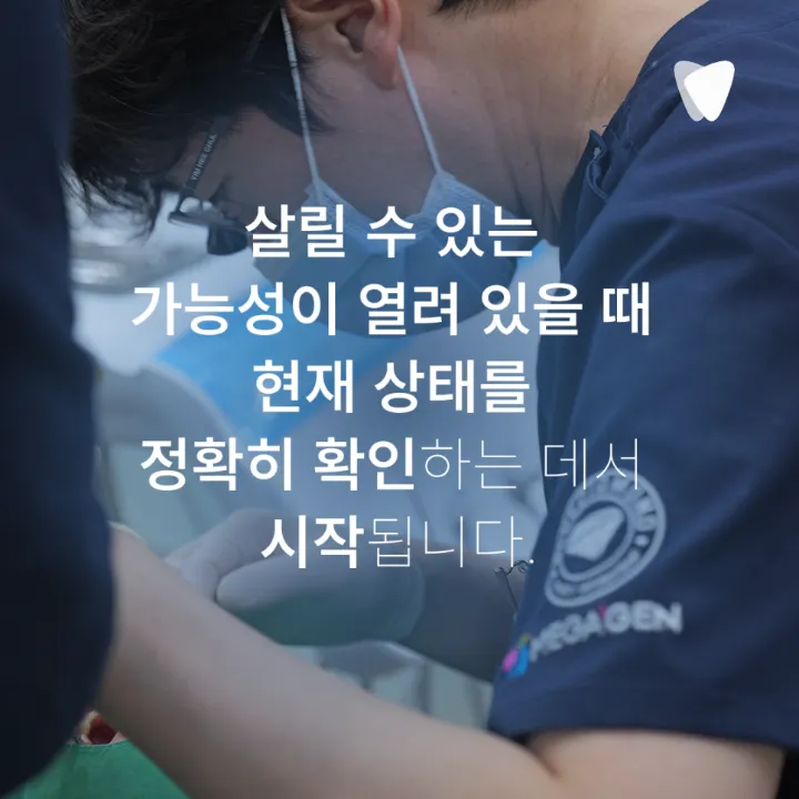 이미지 카드 · 신경치료 미루면 어떻게 될까요? 통증 없어도 치료 범위가 커지는 이유