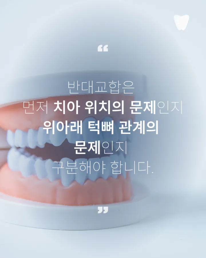 이미지 카드 · 운정 반대교합 투명교정, 가능한 경우는 따로 있습니다