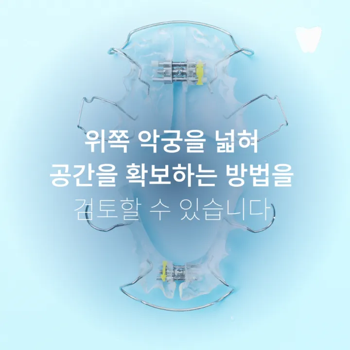 이미지 카드 · 운정 반대교합 투명교정, 가능한 경우는 따로 있습니다