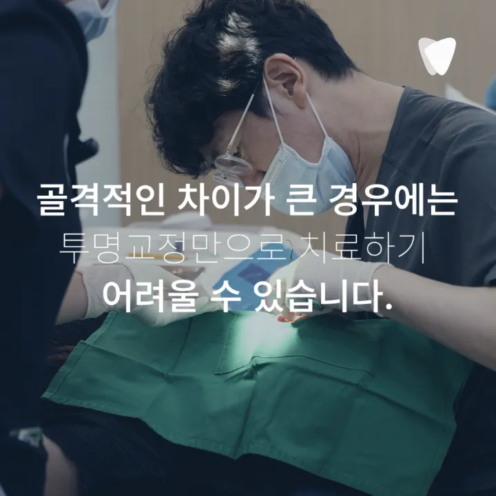 이미지 카드 · 운정 반대교합 투명교정, 가능한 경우는 따로 있습니다