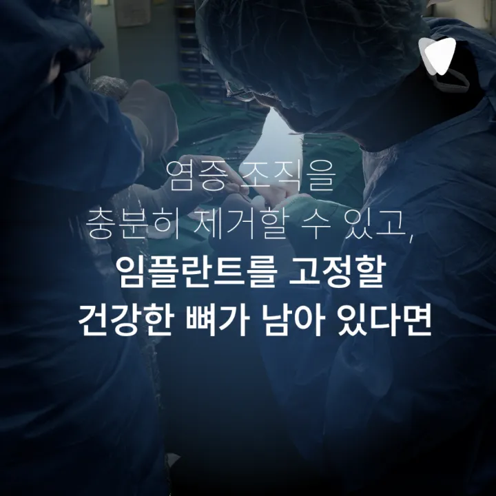 이미지 카드 · 운정 발치 후 임플란트 기간, 바로 할지 기다릴지 기준