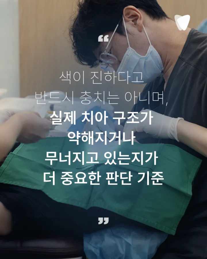 이미지 카드 · 치아의 검은 점은 모두 충치일까요? 착색과 구분하는 방법