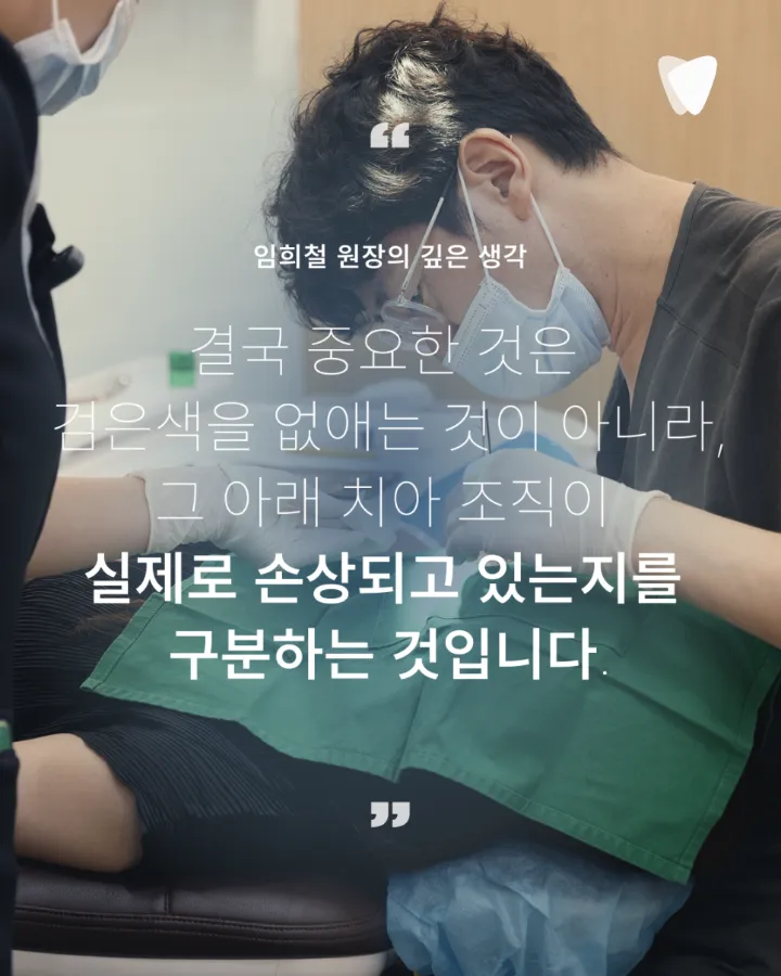 이미지 카드 · 치아의 검은 점은 모두 충치일까요? 착색과 구분하는 방법