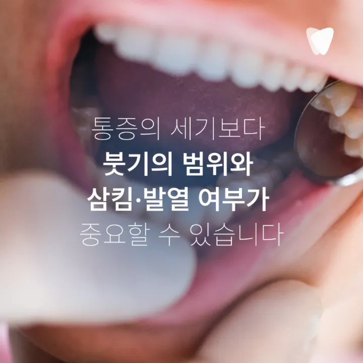 이미지 카드 · 사랑니 주변 잇몸이 붓고 입이 잘 안 벌어지는 이유