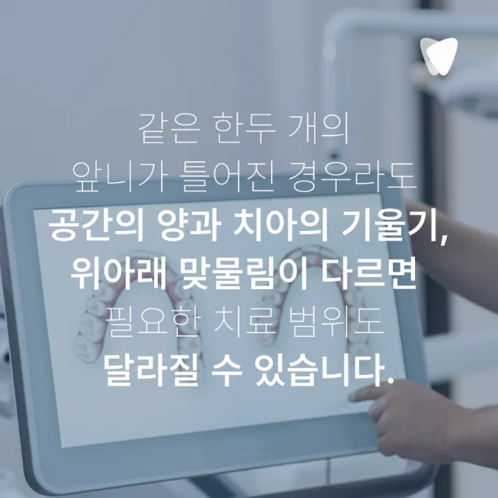 이미지 카드 · 앞니가 조금 틀어졌다면 전체교정이 꼭 필요할까요?